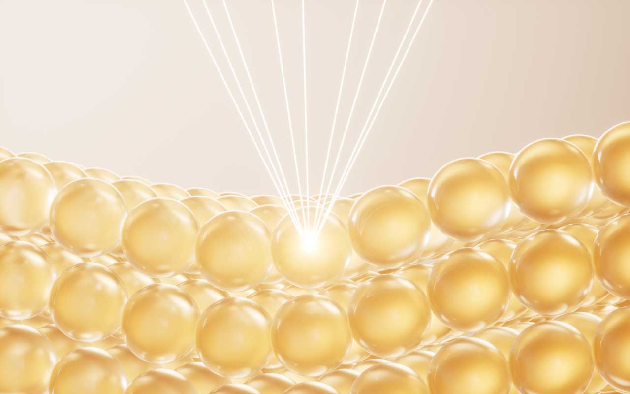 フォトRF・レーザー