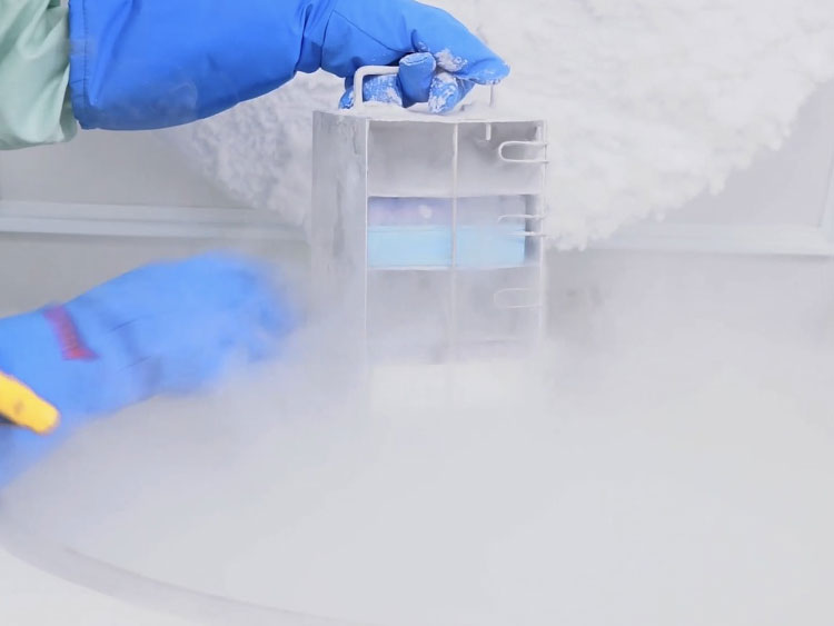 種細胞の冷凍保存